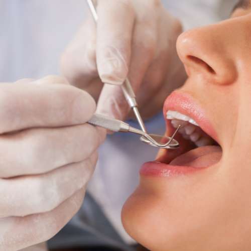 revisión dental en Almería - Dentista en Almería
